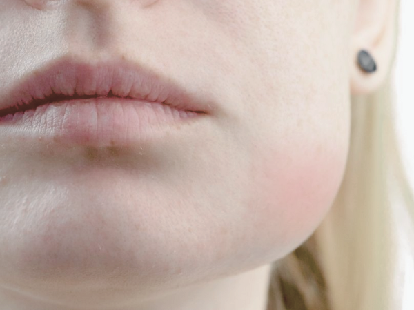 마곡동치과_&ldquo;다시 아프지 않게, 이번엔 제대로!&rdquo; [4. 치근단절제술 후 관리와 재발 방지법] 관련 이미지 2