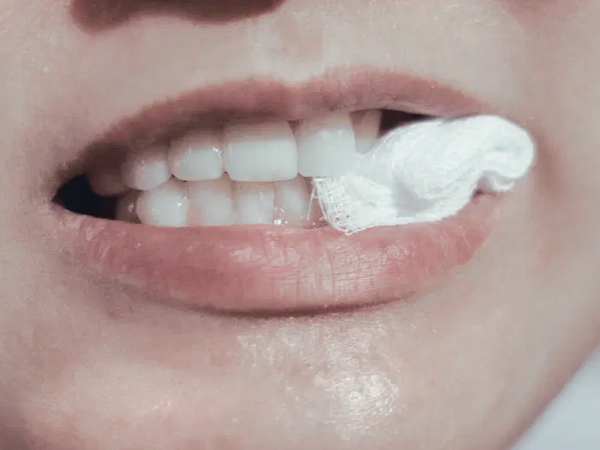 마곡동치과_1. 임플란트 수술 직후, 회복을 좌우하는 관리 기준 관련 이미지 1