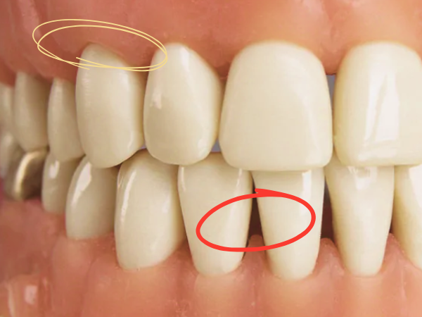 마곡동치과_ 2. 올바른 양치법이란? [하루 3번보다 중요한 방향과 위치 그리고 힘의 기준] 관련 이미지 2