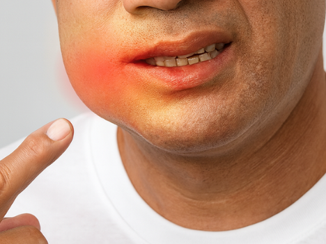 Magok Dental Clinic_5. Is Discomfort After Gum Treatment Normal? A Guide to Pain and Eating Care image 8
