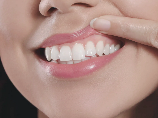 마곡역치과_2. 스케일링 주기, 얼마나 자주 받아야 할까? 소요시간까지 총정리 관련 이미지 2