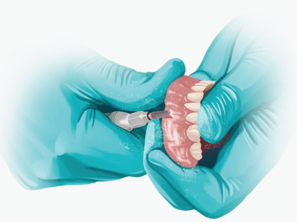 마곡역치과_7. 노년기(70대 이상) 구강관리, 오래 쓰는 치아를 편안하게 지키는 방법 관련 이미지 4