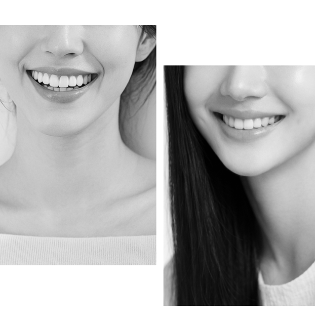 [ Magok Veneers ] Dianate Was Made for People Like You image 3