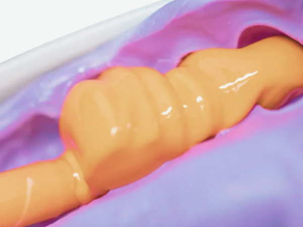 Magok-dong Dental Clinic_ “Not All Dental Impressions Are the Same!” [4. Comprehensive Guide to Impression Materials and Trays] image 5