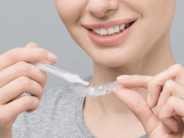 마곡동치과_집에서도 할 수 있는 치아미백? [ 4. 생활치 자가미백 특징과 과정 ] 관련 이미지 2