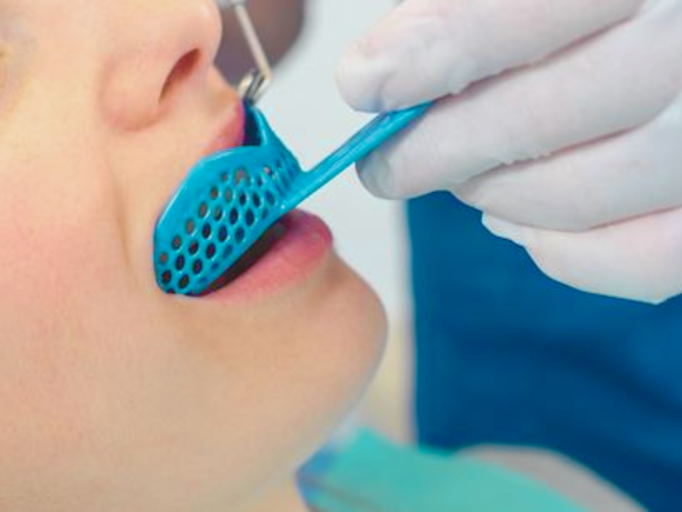 마곡동치과_ "내 입에 딱! 어떻게 만들어질까?" [ 3. 코골이 장치 제작 과정 ] 관련 이미지 2