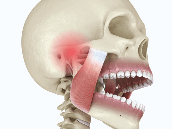 마곡치과_1. 이갈이 장치 필요성과 원리 관련 이미지 4