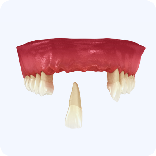 Magaok Station Dental Clinic_ “Gums Alone Won’t Do!” [1. When Dentures Are Needed] image 2