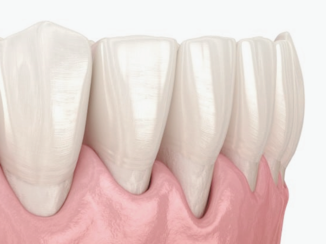 마곡치과_" 찬 음식 앞에서 움찔!" [ 1. 시린이(지각과민증) 원인 ] 관련 이미지 6