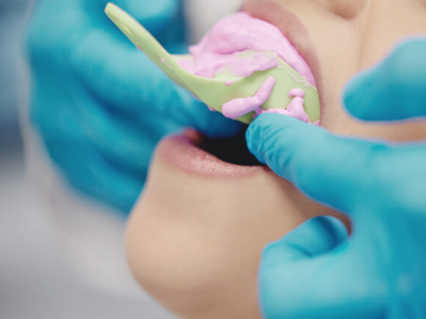 마곡동치과_ &ldquo;치아본만 잘 떠도 반은 성공!&rdquo; [3. 인상채득 진행 과정] 관련 이미지 4