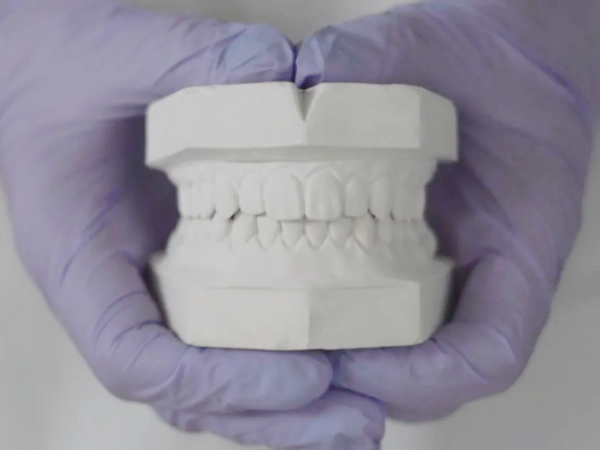 마곡역치과_  "치아 본뜨기란?" [ 1. 인상채득 정의와 중요성 ] 관련 이미지 1