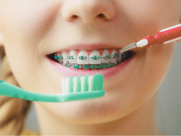 마곡역치과_3. 학령기,청소년(8~18세) 충치 증가 이유와 구강관리 핵심 관련 이미지 5