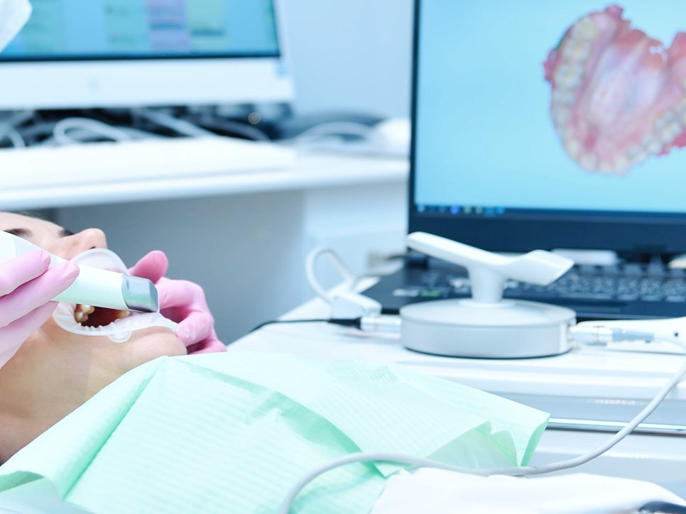 마곡 치과_ 당일 인레이 보철 셋팅 시스템을 소개합니다.( feat. 저스트 스캔) 관련 이미지 5