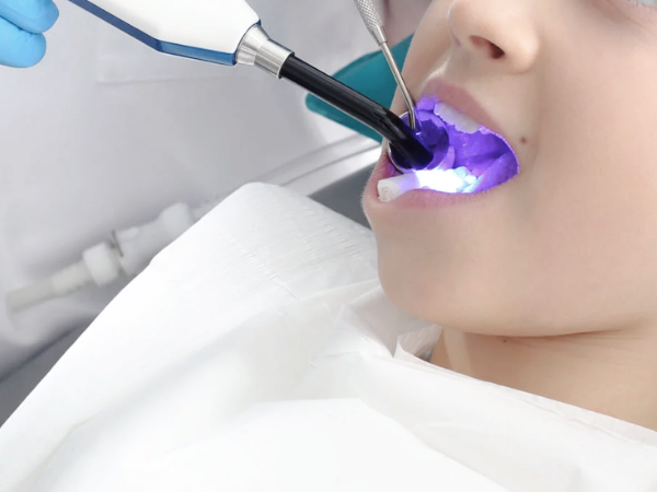 Maggok Station Dental Clinic_“Prevent Cavities Before They Start” [1. What Is Pit and Fissure Sealant?] image 3