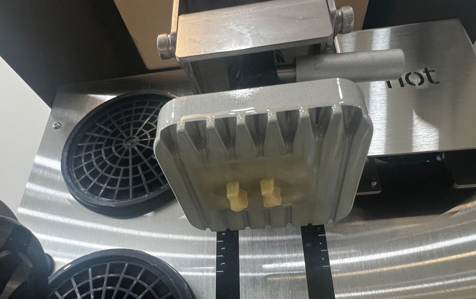 마곡동치과_당일 인레이 치료 과정 관련 이미지 7