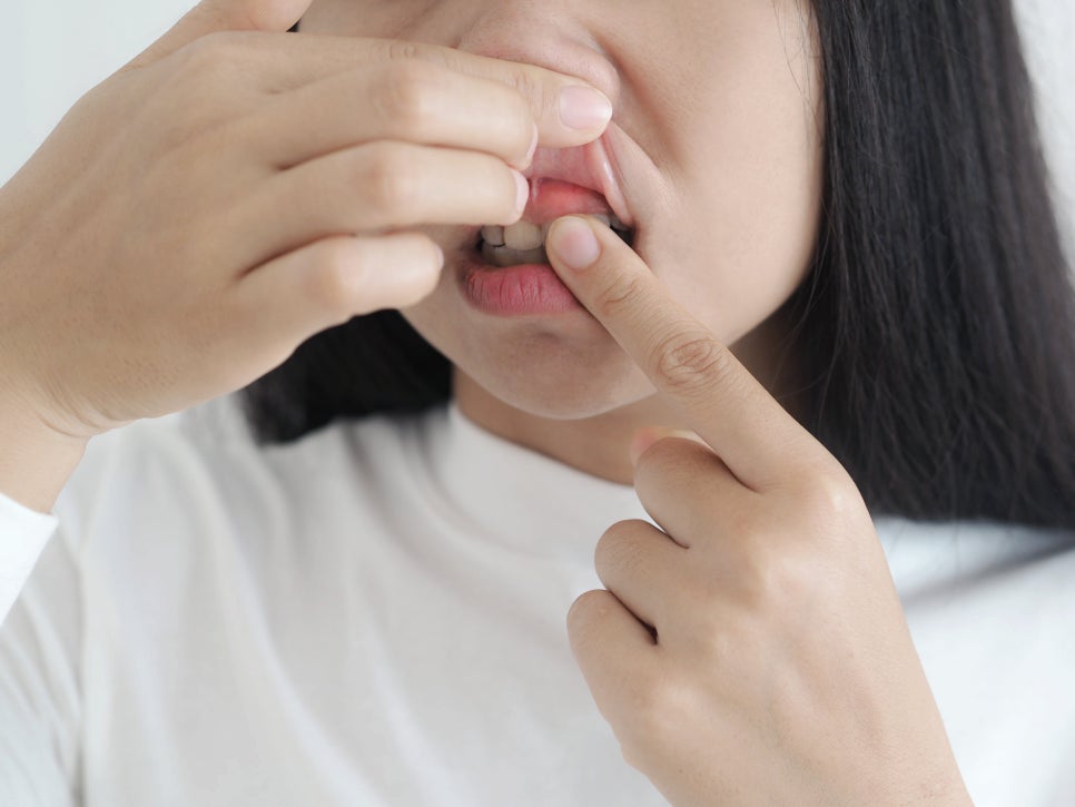 [마곡동치과_치아 흔들림 시리즈5] 이빨이 흔들리는 느낌? 집에서 확인해볼 수 있는 자가진단 방법 관련 이미지 5