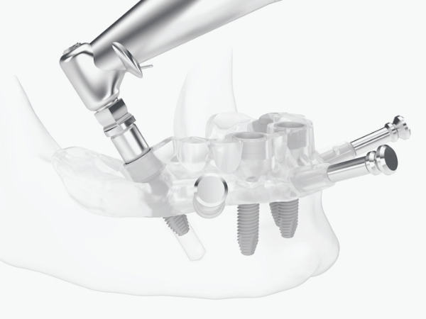 Magok-dong Dental Clinic_4. Full-Mouth Implant Surgery Process: A Step-by-Step Look image 3