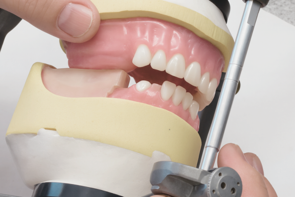 Maggok Station Dental Clinic_“This Is How Dentures Are Completed!” [3. Full Denture Fabrication Process] image 5