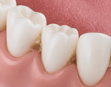 [마곡동치과_치아 흔들림 시리즈5] 이빨이 흔들리는 느낌? 집에서 확인해볼 수 있는 자가진단 방법 관련 이미지 3