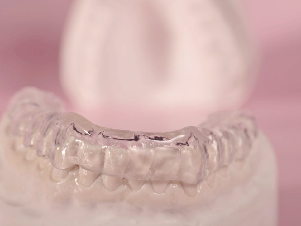 마곡치과_1. 이갈이 장치 필요성과 원리 관련 이미지 7