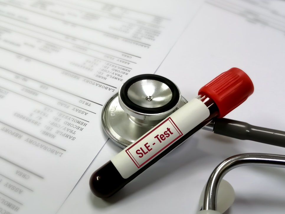 마곡치과_2. 임플란트 수술 전 전신질환별 주의 체크 포인트 관련 이미지 7