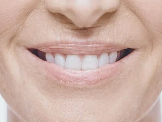 마곡역치과_1. 전악 임플란트란? 언제 필요한 치료일까요? 관련 이미지 5