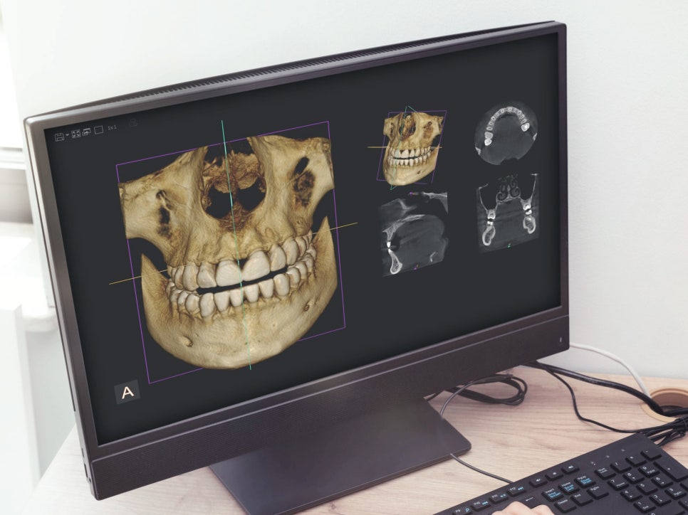 Magok-dong Dental Clinic_2. Why Are There So Many Types of Dental X-ray Radiation? A Clear Summary image 5