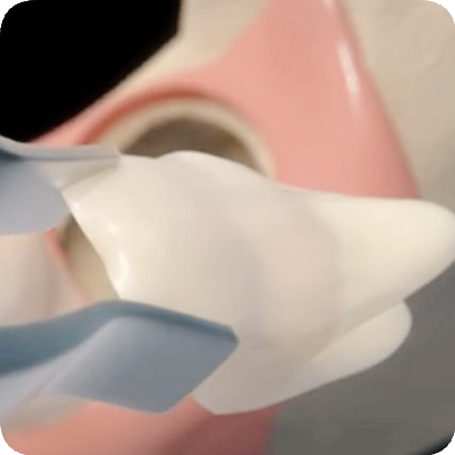 마곡역치과_4. 사랑니 발치, 어떤 과정을 거치나요? 관련 이미지 6