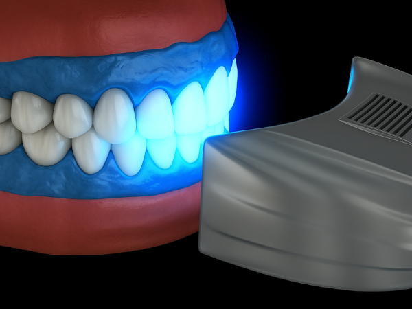 마곡역치과_ 하얀 치아로 가는 가장 빠른 길! [ 3. 생활치 전문가 미백의 특징과 과정 ] 관련 이미지 6