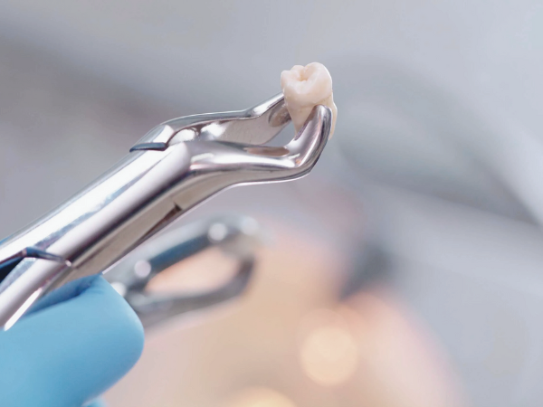 마곡역치과_3. 사랑니 염증 반복되는 이유, 치료해도 다시 불편해질까요? 관련 이미지 5