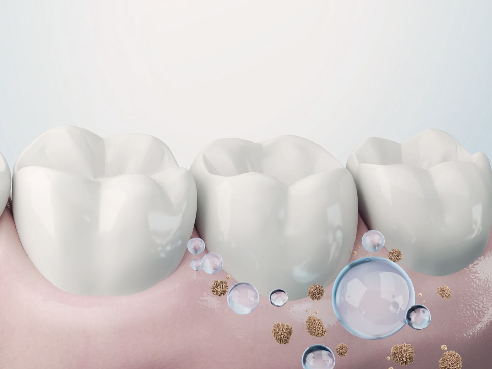 마곡역치과_5. 가글 많이 하면 더 깨끗할까? 소독 가글 올바른 사용법 관련 이미지 1