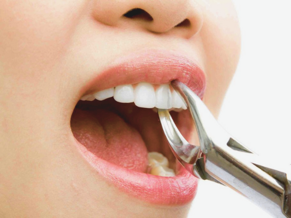 [마곡동치과_치아 흔들림 시리즈2] 흔들리는 이빨, 그냥 두면 어떻게 될까요? 관련 이미지 2