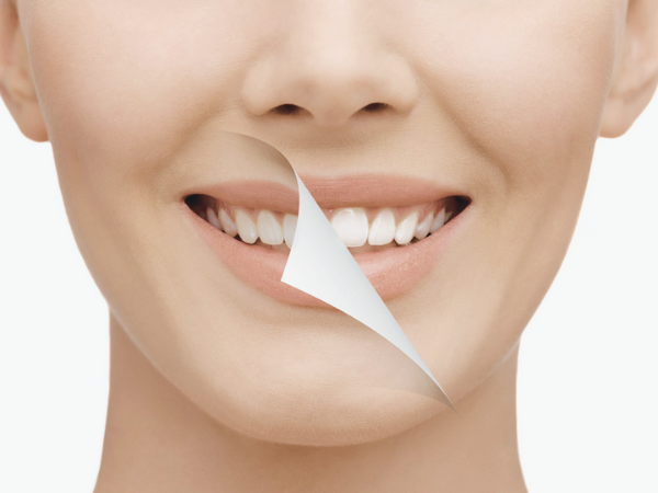 마곡동치과_ 1. 치석 제거는 기본! 스케일링 효과 5가지 총정리 관련 이미지 7