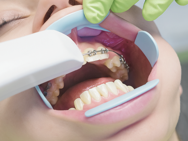 Magok-dong Dental Clinic_ “Taking Dental Impressions with Light!” [5. Digital Impression Taking with a 3D Intraoral Scanner] image 5