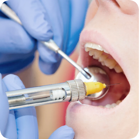 Maggok Dental_3. Gum Surgery: When Periodontal Flap Surgery Is Needed and the Treatment Process image 3