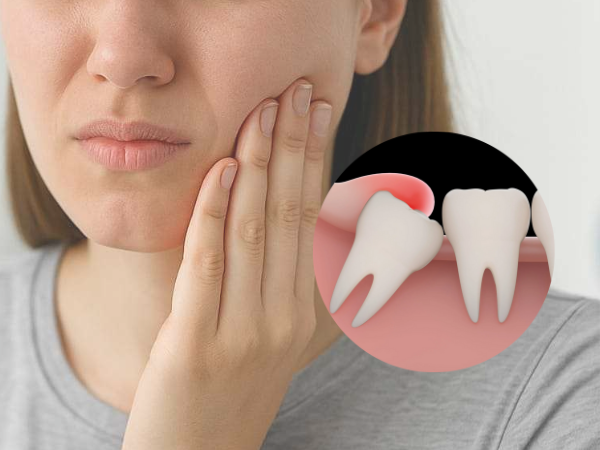 마곡동치과_1. 사랑니염증 원인, 왜 유독 사랑니만 문제를 만들까요? 관련 이미지 4