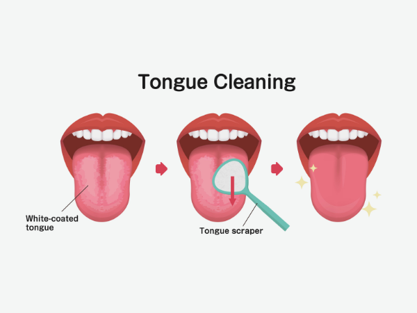 마곡역치과_7. 혀 클리너 꼭 써야 할까요? 설태 생기는 진짜 이유와 올바른 사용 기준 관련 이미지 4