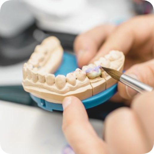 마곡역치과_5. 인레이 보철물 떨어지는 이유 [ 탈락 원인과 재접착 가능한 경우는? ] 관련 이미지 1