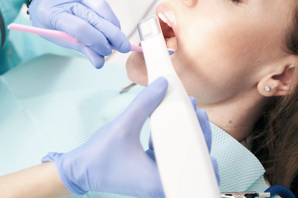 마곡동치과_당일 인레이 치료 과정 관련 이미지 5