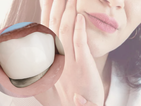 마곡치과_2. 재신경치료 필요한 상황 4가지, 신경치료 했는데 다시 아프다면? 관련 이미지 4