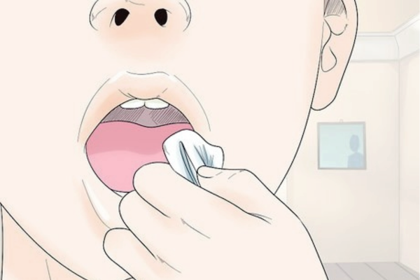 마곡동치과_5. 임플란트 뼈이식 수술 후 꼭 지켜야 할 주의사항 관련 이미지 2