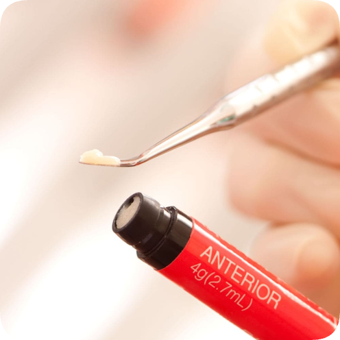 마곡치과_"이럴 땐 레진이 답입니다" [ 1. 치과 레진 활용법 ] 관련 이미지 1