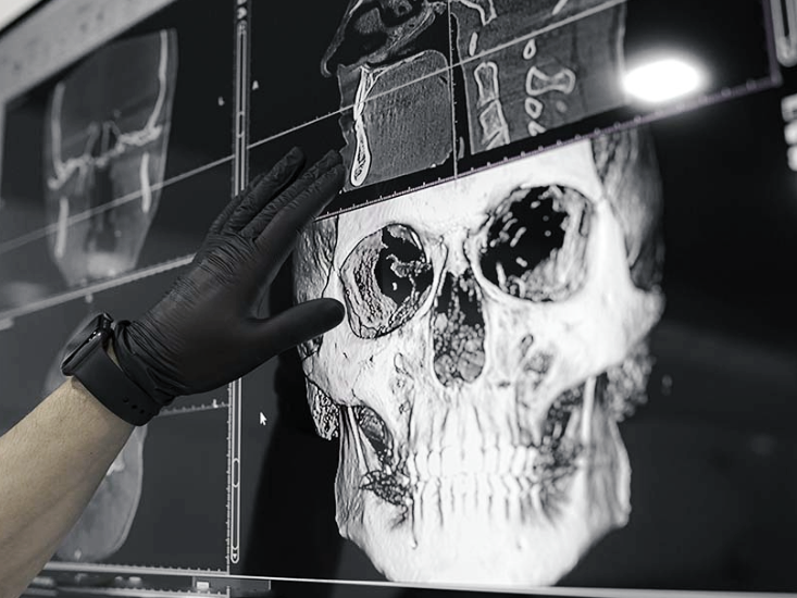 마곡치과_1. 임플란트 수술 전 꼭 짚고 가야 할 기준 5가지 관련 이미지 1