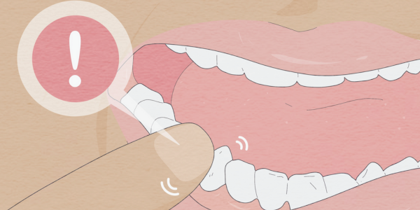 마곡동치과_4. 치주질환 진단검사로 잇몸병 진행 정도 바로 확인하세요! 관련 이미지 3