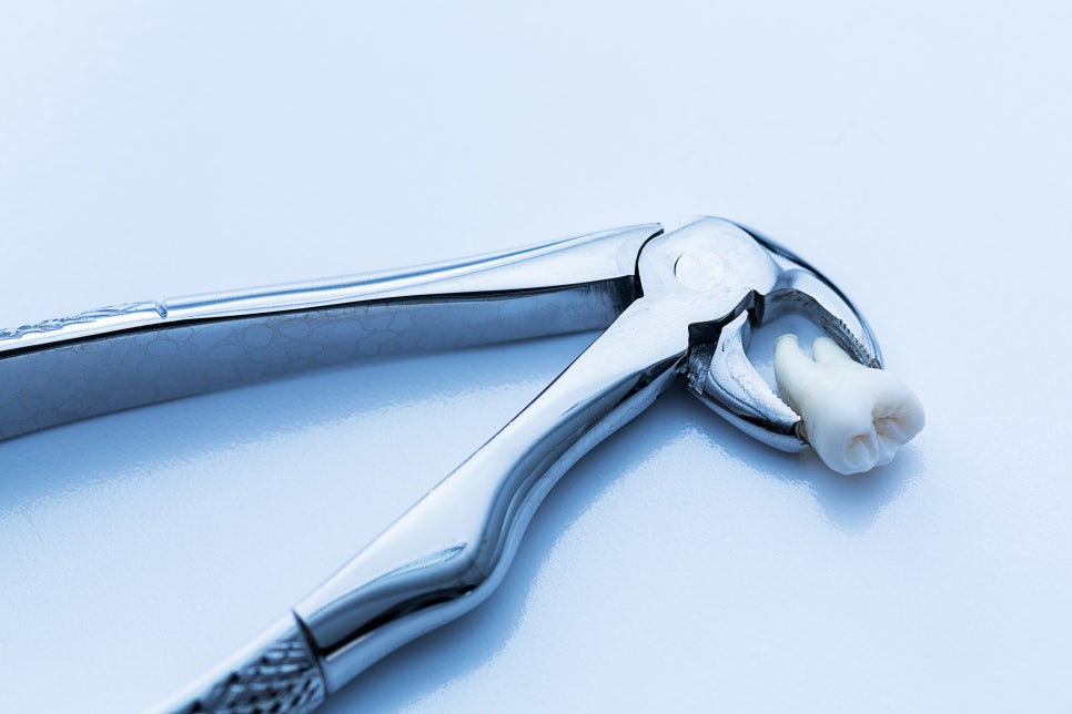 [ Magok Dental_01 ] Do wisdom teeth have to be removed no matter what? There are cases where extraction is not necessary image 1