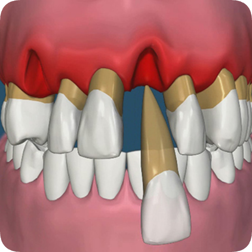 Magaok Station Dental Clinic_ “Gums Alone Won’t Do!” [1. When Dentures Are Needed] image 3