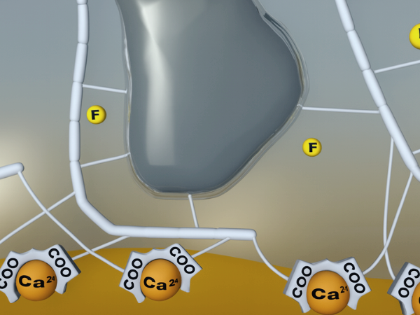 마곡역치과_ 1. 글래스아이오노머(GI) 특징과 장단점 관련 이미지 4