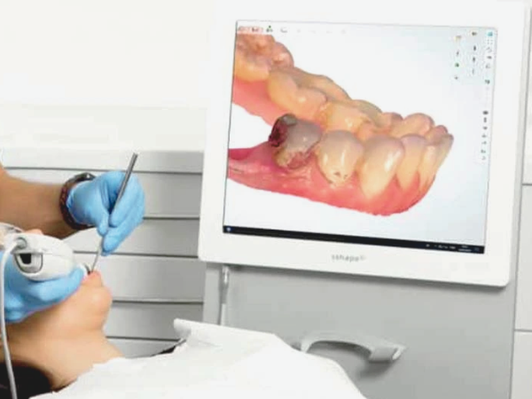 마곡치과_"CT 분석부터 가이드 제작까지!"[2. 3D 네비게이션 임플란트 진행과정] 관련 이미지 1