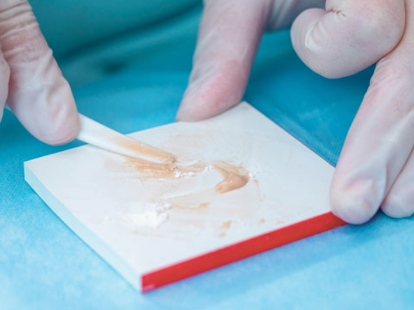 마곡역치과_ 3. 글래스아이오노머(GI) 비용 [feat. 건강보험] 관련 이미지 1