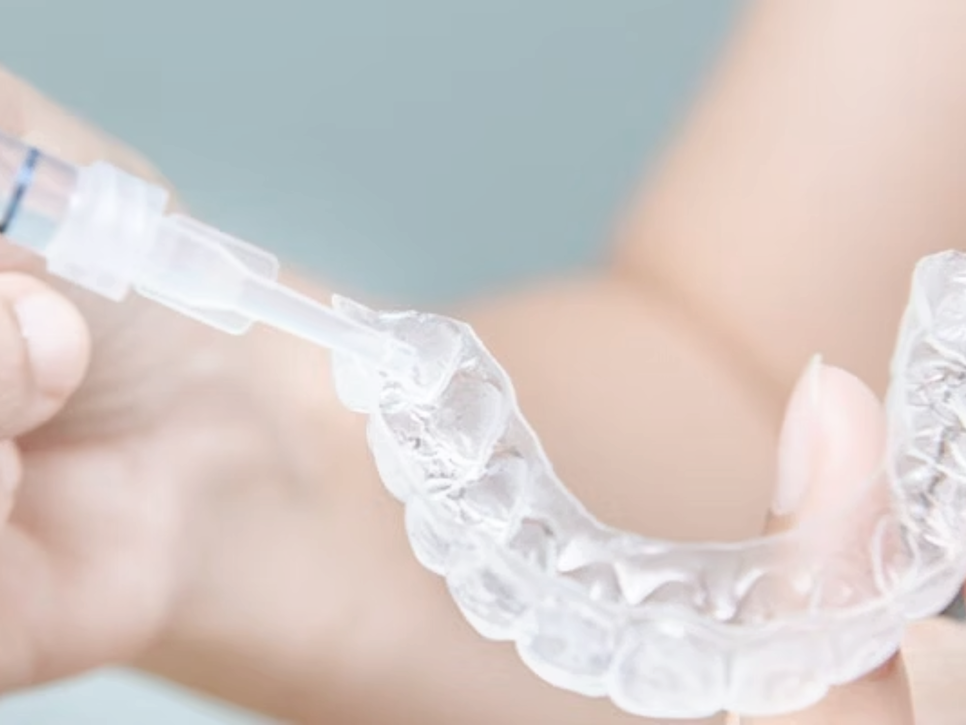 마곡동치과_전문가 미백 관련 이미지 1